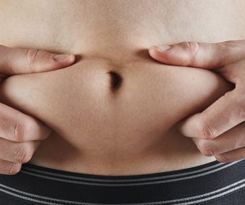 Gordura abdominal e síndrome metabólica