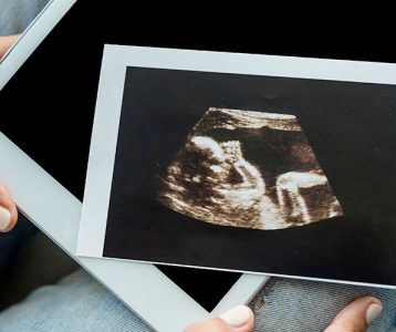 Software para identificação de sofrimento fetal